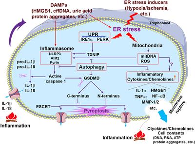 Etiological Value of Sterile Inflammation in Preeclampsia: Is It a Non-Infectious Pregnancy Complication?